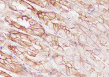 FGFR2 Recombinant Rabbit Monoclonal Antibody