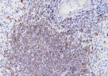 CD22 Recombinant Rabbit Monoclonal Antibody