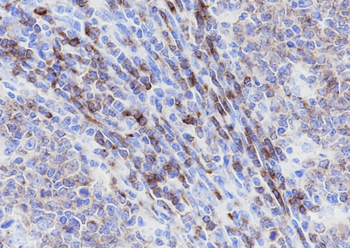 CD22 Recombinant Rabbit Monoclonal Antibody