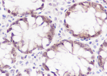 Caspase-7 Recombinant Rabbit Monoclonal Antibody