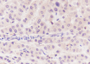 Caspase-7 Recombinant Rabbit Monoclonal Antibody