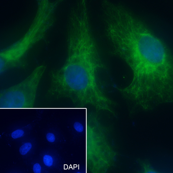 CK-7 Recombinant Rabbit Monoclonal Antibody