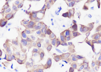 CK-7 Recombinant Rabbit Monoclonal Antibody