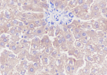 TNS4 Recombinant Rabbit Monoclonal Antibody