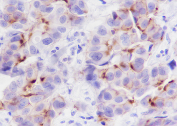 Phospho-Girdin (Tyr1765) Recombinant Rabbit Monoclonal Antibody