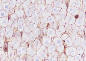 Phospho-Girdin (Tyr1765) Recombinant Rabbit Monoclonal Antibody