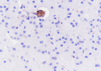 HBA1 Recombinant Rabbit Monoclonal Antibody