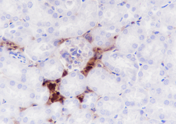 HBA1 Recombinant Rabbit Monoclonal Antibody