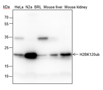Ubiquityl-Histone H2B (Lys120) Recombinant Rabbit Monoclonal Antibody