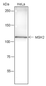 MSH2 Recombinant Rabbit Monoclonal Antibody