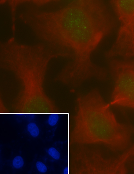 MSH2 Recombinant Rabbit Monoclonal Antibody