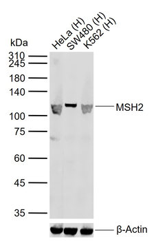 MSH2 Recombinant Rabbit Monoclonal Antibody