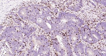 CD7 Recombinant Rabbit Monoclonal Antibody