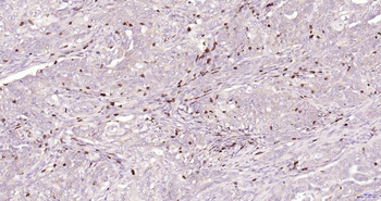 CD7 Recombinant Rabbit Monoclonal Antibody