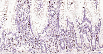 CD7 Recombinant Rabbit Monoclonal Antibody