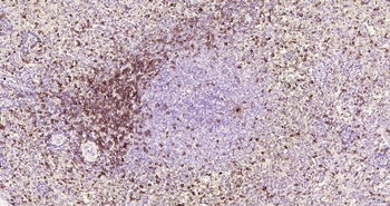 CD7 Recombinant Rabbit Monoclonal Antibody