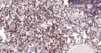 CD7 Recombinant Rabbit Monoclonal Antibody