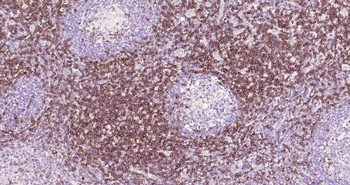CD7 Recombinant Rabbit Monoclonal Antibody