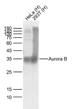 Aurora B Recombinant Rabbit Monoclonal Antibody