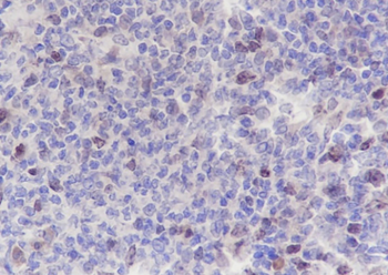 Aurora B Recombinant Rabbit Monoclonal Antibody