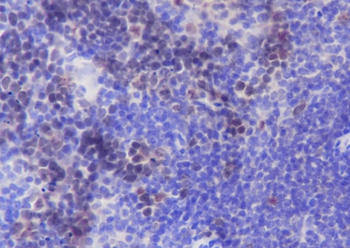 Aurora B Recombinant Rabbit Monoclonal Antibody