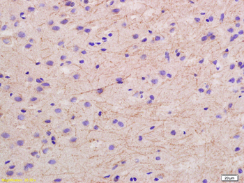 NF-L Rabbit Polyclonal Antibody