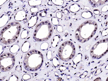 DDX3 Rabbit Polyclonal Antibody