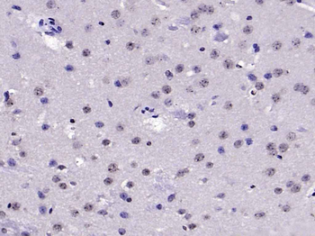 DDX3 Rabbit Polyclonal Antibody