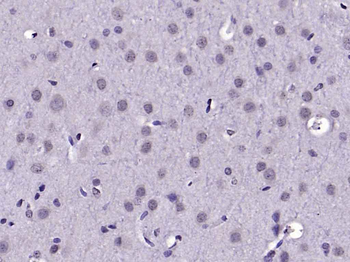 DDX3 Rabbit Polyclonal Antibody