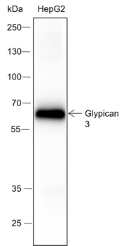 Glypican 3 Recombinant Rabbit Monoclonal Antibody
