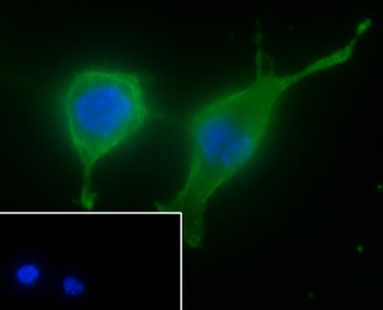 BMP6 Recombinant Rabbit Monoclonal Antibody