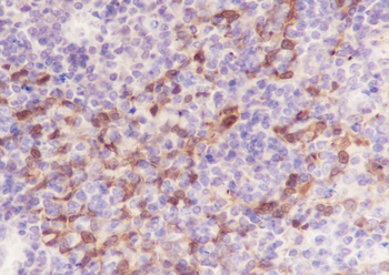 14-3-3 sigma Recombinant Mouse Monoclonal Antibody