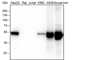 ALDH1A1 Recombinant Rabbit Monoclonal Antibody