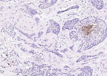 ALDH1A1 Recombinant Rabbit Monoclonal Antibody