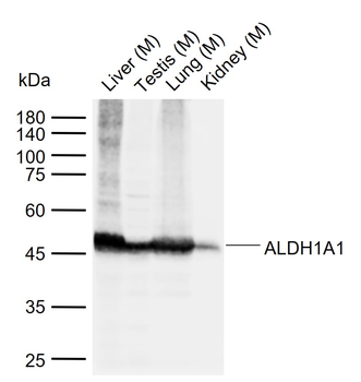 ALDH1A1 Recombinant Rabbit Monoclonal Antibody