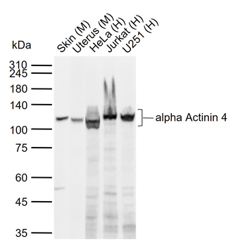 Alpha Actinin 4 Recombinant Rabbit Monoclonal Antibody
