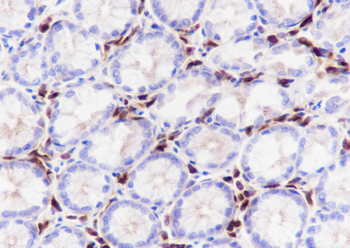 JCHAIN Recombinant Rabbit Monoclonal Antibody