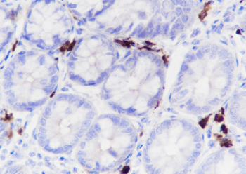 JCHAIN Recombinant Rabbit Monoclonal Antibody
