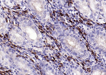 JCHAIN Recombinant Rabbit Monoclonal Antibody