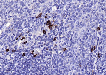 JCHAIN Recombinant Rabbit Monoclonal Antibody