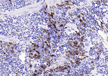 JCHAIN Recombinant Rabbit Monoclonal Antibody