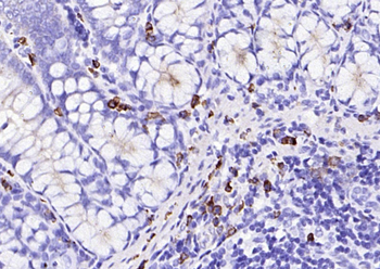 JCHAIN Recombinant Rabbit Monoclonal Antibody