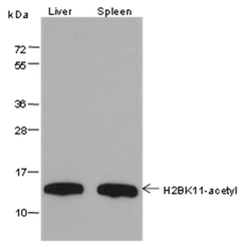 Histone H2B (Acetyl K11) Mouse Monoclonal Antibody