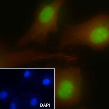 CDKN2A/p14ARF Recombinant Rabbit Monoclonal Antibody