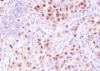 CDKN2A/p14ARF Recombinant Rabbit Monoclonal Antibody