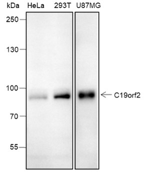 URI1 Recombinant Rabbit Monoclonal Antibody