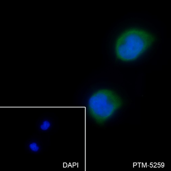 URI1 Recombinant Rabbit Monoclonal Antibody
