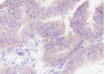 URI1 Recombinant Rabbit Monoclonal Antibody