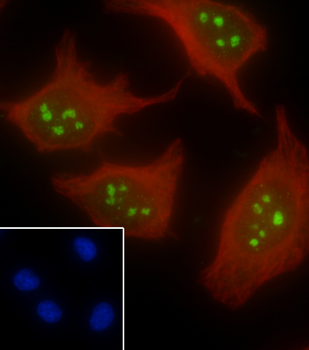 AATF Recombinant Rabbit Monoclonal Antibody