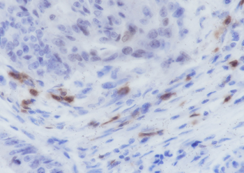 ITGAE/CD103 Recombinant Rabbit Monoclonal Antibody